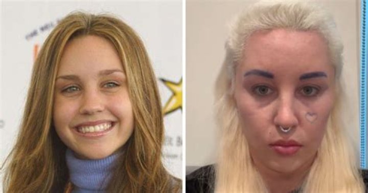 Amanda Bynes: A Comprehensive Look into Her Life and Career