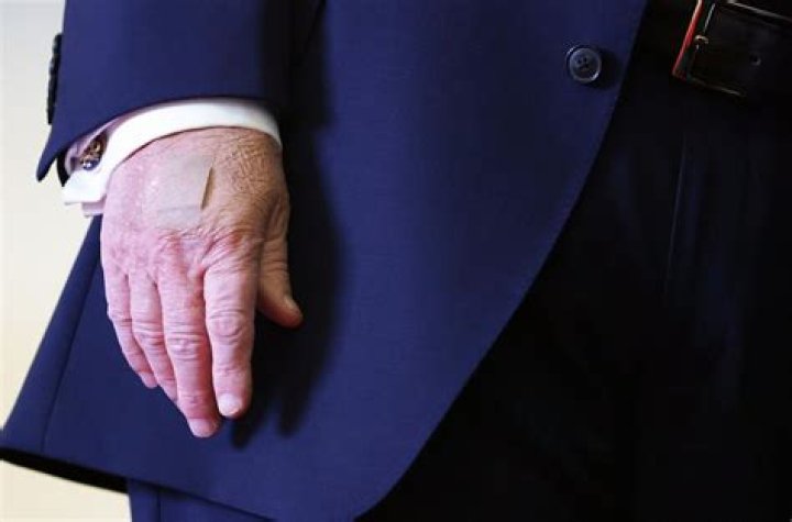 Understanding Trump Bandage: A Comprehensive Guide