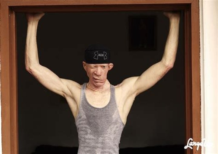 What Happened to King Yellowman? The Rise, Struggles, and Legacy of a Reggae Icon